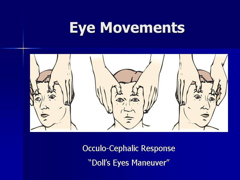 Eye Movements  Occulo-Cephalic Response “Doll’s Eyes Maneuver”